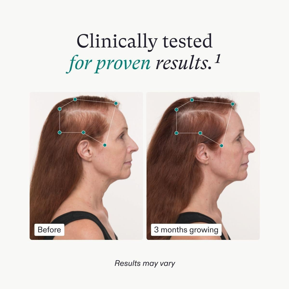 Cross-border Hot Selling TK Hot Women Biotin Hair Supplement Capsules Women's Hair Growth
